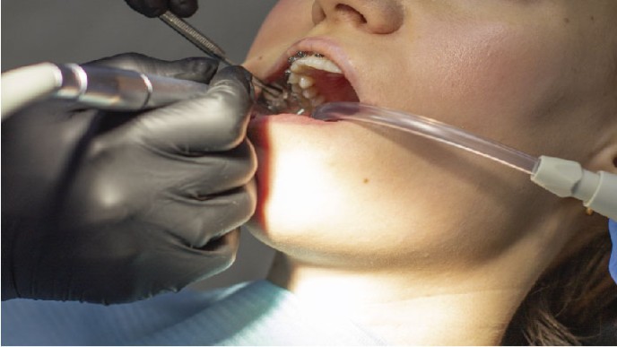 100532_cada-cuanto-hacer-una-limpieza-dental-profesional.jpg