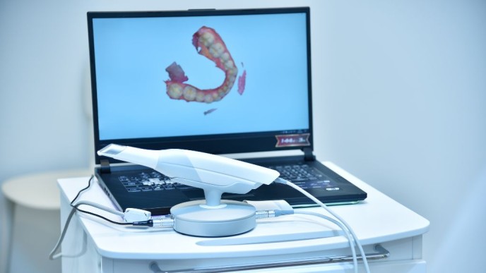 Escáner dental 3D: ¿qué es y cómo funciona?