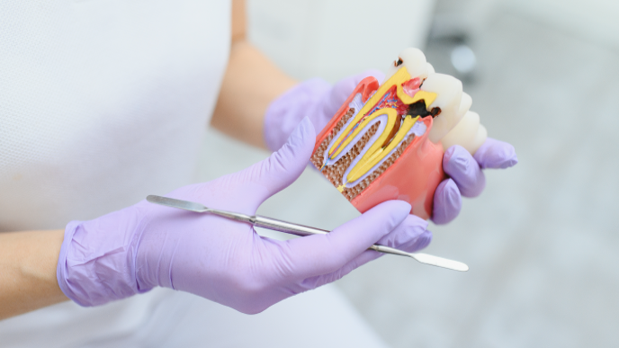 Caries en adultos: causas y tratamientos más habituales