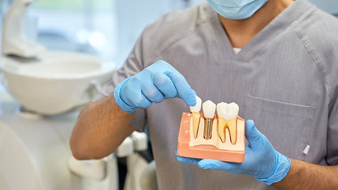 ¿Cuánto cuesta un implante dental en Castellón? Precios, dudas y recomendaciones