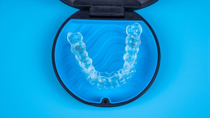 ¿Se puede llevar Invisalign con implantes?