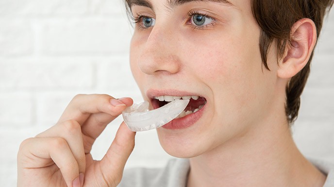 Cómo limpiar férulas dentales muy sucias